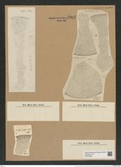 Coscinodiscus oculus-iridis Ehr. (de-Toni-Nr.: Genus 202, Species 5054) Zeichnungen Sammlung Grunow Nr. 8803 (NHMW-BOT-W0378409)